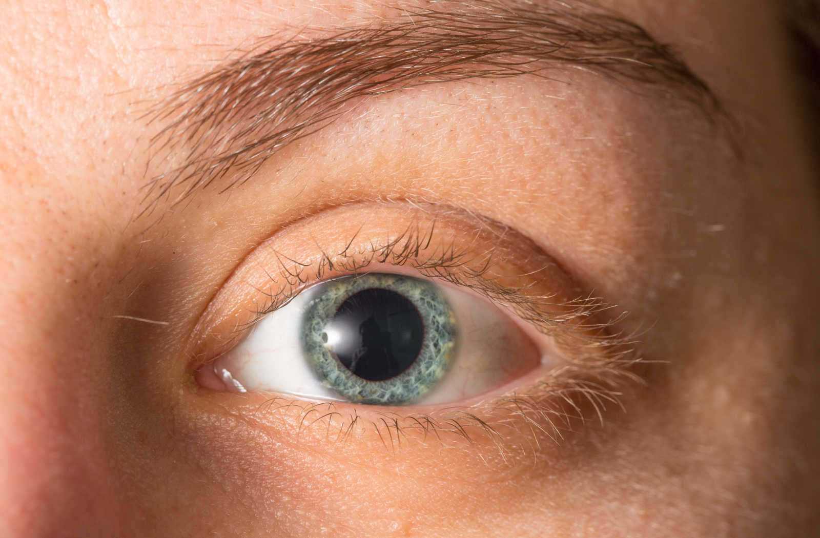 What Can Your Eyes Tell You About Your Health?