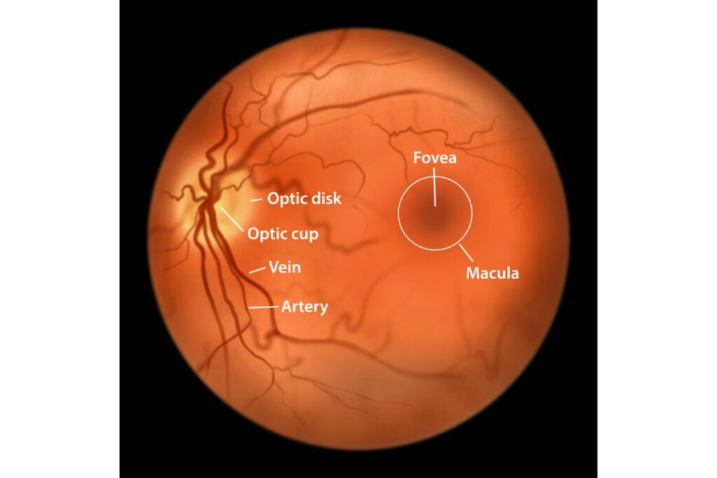 A detailed fundus photograph of a human retina with labels pointing to the optic disk, optic cup, vein, artery, macula, and fovea.